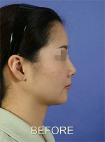 Mizain Aesthetic Clinic, Reviews,Images,Promotions — Korea cost, reviews & before-after | MISOODA