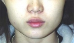 Mizain Aesthetic Clinic, Reviews,Images,Promotions — Korea cost, reviews & before-after | MISOODA