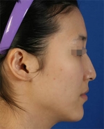 Mizain Aesthetic Clinic, Reviews,Images,Promotions — Korea cost, reviews & before-after | MISOODA