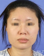 Mizain Aesthetic Clinic, Reviews,Images,Promotions — Korea cost, reviews & before-after | MISOODA