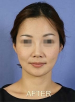 Mizain Aesthetic Clinic, Reviews,Images,Promotions — Korea cost, reviews & before-after | MISOODA