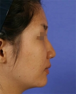 Mizain Aesthetic Clinic, Reviews,Images,Promotions — Korea cost, reviews & before-after | MISOODA