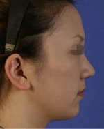 Mizain Aesthetic Clinic, Reviews,Images,Promotions — Korea cost, reviews & before-after | MISOODA