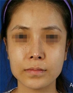 Mizain Aesthetic Clinic, Reviews,Images,Promotions — Korea cost, reviews & before-after | MISOODA