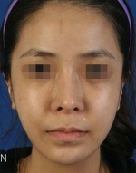 Mizain Aesthetic Clinic, Reviews,Images,Promotions — Korea cost, reviews & before-after | MISOODA