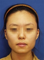 Mizain Aesthetic Clinic, Reviews,Images,Promotions — Korea cost, reviews & before-after | MISOODA