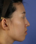 Mizain Aesthetic Clinic, Reviews,Images,Promotions — Korea cost, reviews & before-after | MISOODA