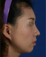 Mizain Aesthetic Clinic, Reviews,Images,Promotions — Korea cost, reviews & before-after | MISOODA