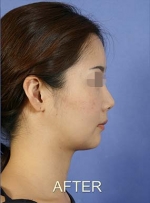 Mizain Aesthetic Clinic, Reviews,Images,Promotions — Korea cost, reviews & before-after | MISOODA