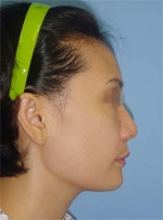 Mizain Aesthetic Clinic, Reviews,Images,Promotions — Korea cost, reviews & before-after | MISOODA