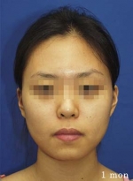 Mizain Aesthetic Clinic, Reviews,Images,Promotions — Korea cost, reviews & before-after | MISOODA