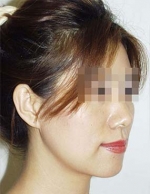 Mizain Aesthetic Clinic, Reviews,Images,Promotions — Korea cost, reviews & before-after | MISOODA