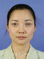 Mizain Aesthetic Clinic, Reviews,Images,Promotions — Korea cost, reviews & before-after | MISOODA