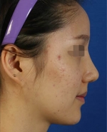 Mizain Aesthetic Clinic, Reviews,Images,Promotions — Korea cost, reviews & before-after | MISOODA