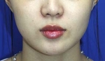 Mizain Aesthetic Clinic, Reviews,Images,Promotions — Korea cost, reviews & before-after | MISOODA