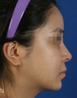 Mizain Aesthetic Clinic, Reviews,Images,Promotions — Korea cost, reviews & before-after | MISOODA