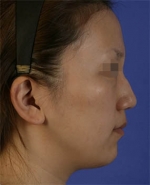 Mizain Aesthetic Clinic, Reviews,Images,Promotions — Korea cost, reviews & before-after | MISOODA