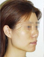 Mizain Aesthetic Clinic, Reviews,Images,Promotions — Korea cost, reviews & before-after | MISOODA
