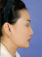 Mizain Aesthetic Clinic, Reviews,Images,Promotions — Korea cost, reviews & before-after | MISOODA