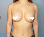 breast