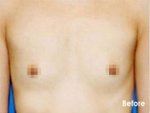 Izien Plastic Surgery,Reviews,Images, Promotions — Korea cost, reviews & before-after | MISOODA