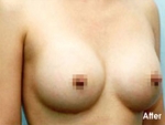 Izien Plastic Surgery,Reviews,Images, Promotions — Korea cost, reviews & before-after | MISOODA