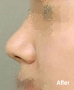 Izien Plastic Surgery,Reviews,Images, Promotions — Korea cost, reviews & before-after | MISOODA