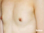 Izien Plastic Surgery,Reviews,Images, Promotions — Korea cost, reviews & before-after | MISOODA