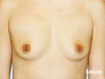 Izien Plastic Surgery,Reviews,Images, Promotions — Korea cost, reviews & before-after | MISOODA