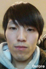 Izien Plastic Surgery,Reviews,Images, Promotions — Korea cost, reviews & before-after | MISOODA