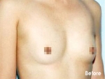 Izien Plastic Surgery,Reviews,Images, Promotions — Korea cost, reviews & before-after | MISOODA
