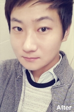 Izien Plastic Surgery,Reviews,Images, Promotions — Korea cost, reviews & before-after | MISOODA