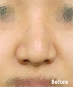 Izien Plastic Surgery,Reviews,Images, Promotions — Korea cost, reviews & before-after | MISOODA