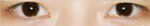 Izien Plastic Surgery,Reviews,Images, Promotions — Korea cost, reviews & before-after | MISOODA