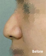 Izien Plastic Surgery,Reviews,Images, Promotions — Korea cost, reviews & before-after | MISOODA