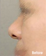 Izien Plastic Surgery,Reviews,Images, Promotions — Korea cost, reviews & before-after | MISOODA