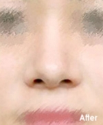 Izien Plastic Surgery,Reviews,Images, Promotions — Korea cost, reviews & before-after | MISOODA