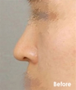 Izien Plastic Surgery,Reviews,Images, Promotions — Korea cost, reviews & before-after | MISOODA