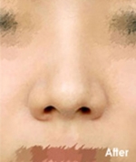 Izien Plastic Surgery,Reviews,Images, Promotions — Korea cost, reviews & before-after | MISOODA