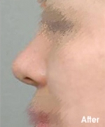 Izien Plastic Surgery,Reviews,Images, Promotions — Korea cost, reviews & before-after | MISOODA