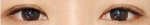 Izien Plastic Surgery,Reviews,Images, Promotions — Korea cost, reviews & before-after | MISOODA