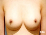 Izien Plastic Surgery,Reviews,Images, Promotions — Korea cost, reviews & before-after | MISOODA