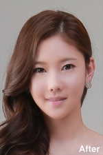 Izien Plastic Surgery,Reviews,Images, Promotions — Korea cost, reviews & before-after | MISOODA