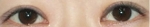 Izien Plastic Surgery,Reviews,Images, Promotions — Korea cost, reviews & before-after | MISOODA