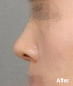 Izien Plastic Surgery,Reviews,Images, Promotions — Korea cost, reviews & before-after | MISOODA