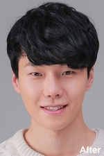 Izien Plastic Surgery,Reviews,Images, Promotions — Korea cost, reviews & before-after | MISOODA