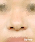Izien Plastic Surgery,Reviews,Images, Promotions — Korea cost, reviews & before-after | MISOODA