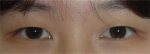 ABC Plastic Surgery,Reviews,Images, Promotions — Korea cost, reviews & before-after | MISOODA