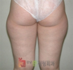 GangNam June Cosmetic Surgery Clinic,Reviews,Images, Promotions — Korea cost, reviews & before-after | MISOODA