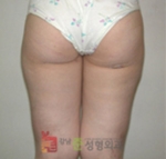 GangNam June Cosmetic Surgery Clinic,Reviews,Images, Promotions — Korea cost, reviews & before-after | MISOODA